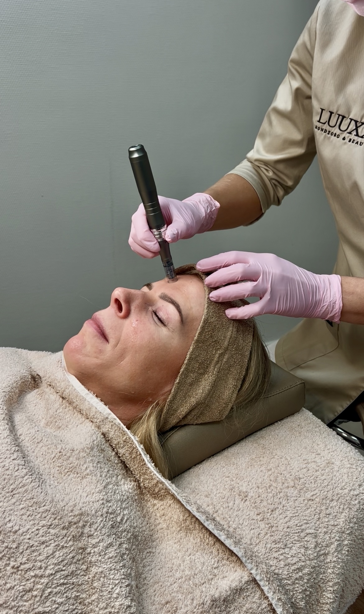 micro needling behandeling bij Praktijk Luuxx in Epe